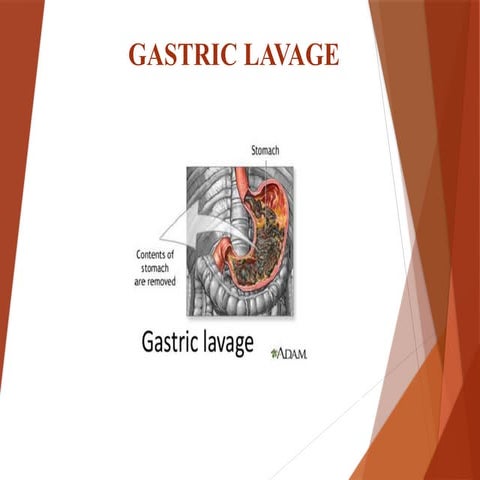 Gastric_Lavage_Presentation in obstetrics and gynaecological nursing