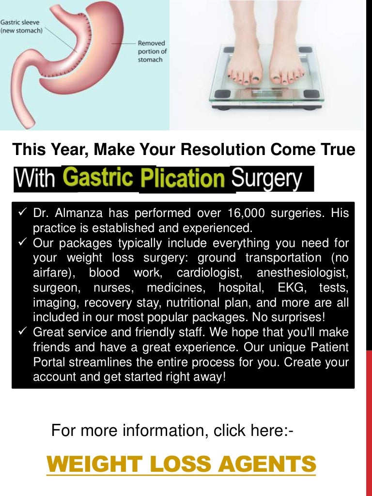Gastric sleeve surgery