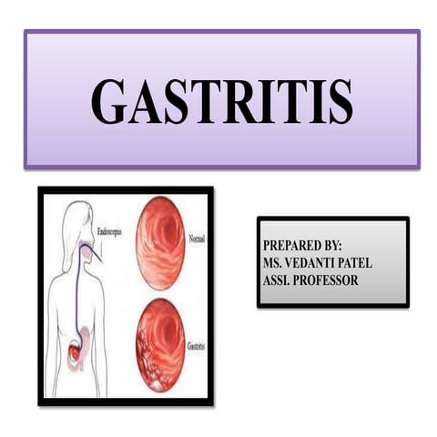 Gastritis.pptx Gastro Intestinal Disorder