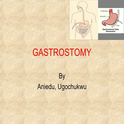 Gastrostomy
