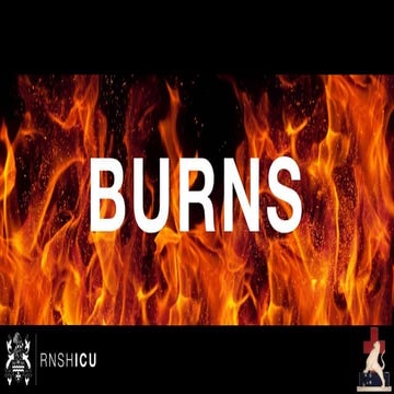 Burns Airway Management by Gatward