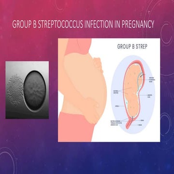 GBS in pregnancy - explaining the GBS.pptx
