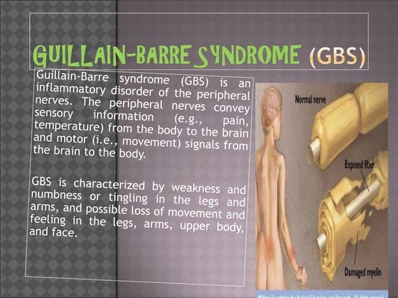 Guillain Barre syndrome (GBS) slide share | PPTX