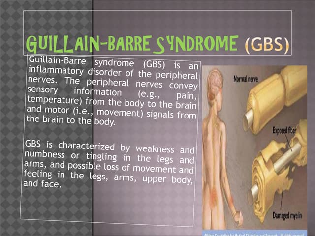Guillain Barre syndrome (GBS) slide share | PPTX