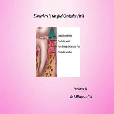 GINGIVAL CREVICULAR FLUID | PPTX