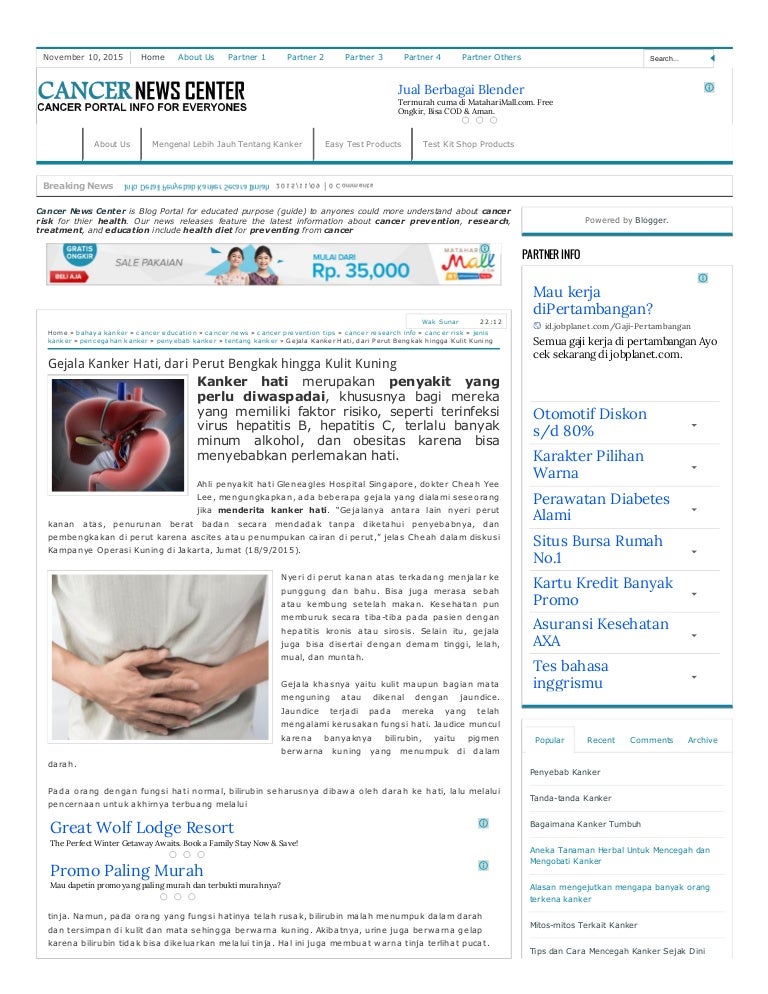 Sinusitis Qu Es Sntomas Tratamiento Y Cmo Aliviarla Saber Vivir Sinusitis Qu Es Sntomas Tratamiento Y Cmo Aliviarla Saber Vivir