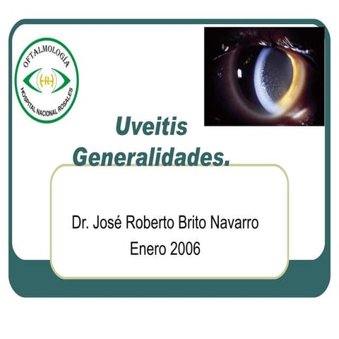 Generalidades de Uveitis