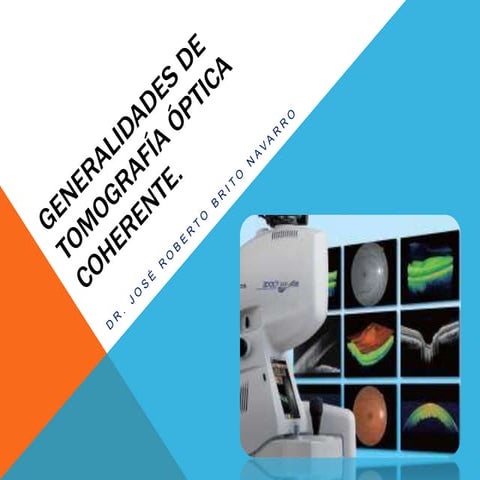 Generalidades de OCT