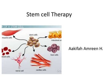 Stem cell Therapy
