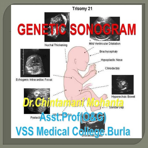 Genetic sonogram