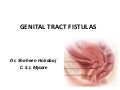 Genital tract fistulas  main