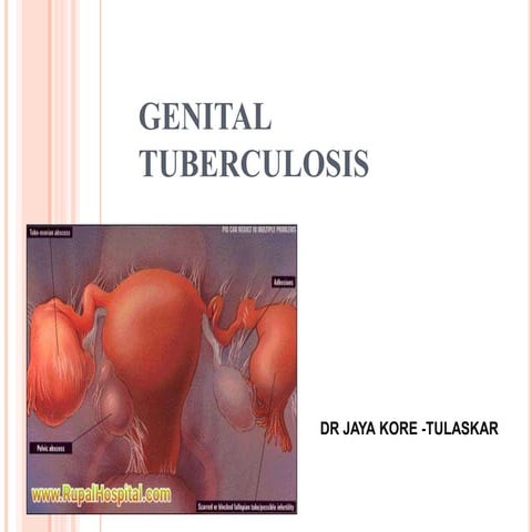 Genital tuberculosis