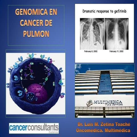 Genomica en cancer de pulmon.final.1