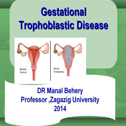 Gestational trophoblastic disease for undergraduate