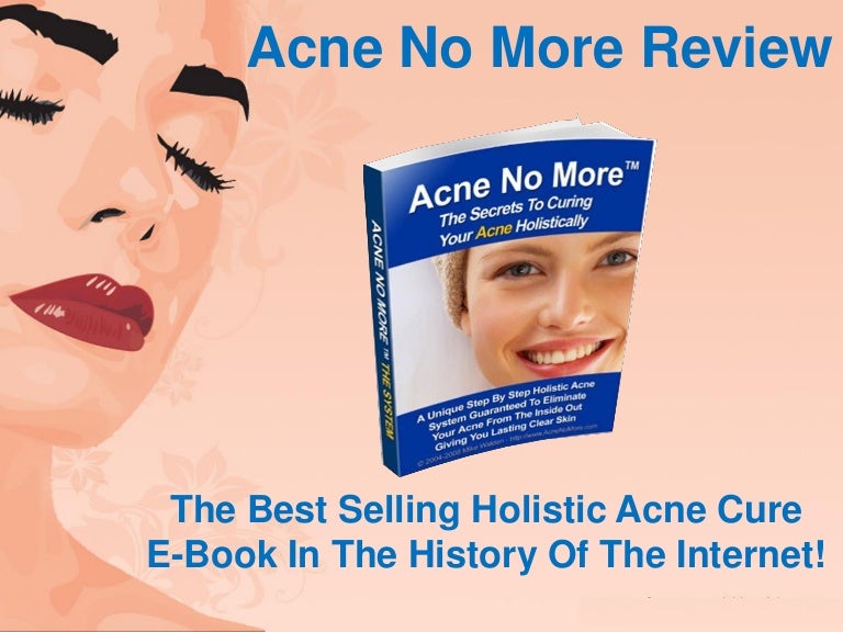 Download Acne No More Free Pdf