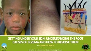 Your Acne Can Be Treated These Kinds Of Tips