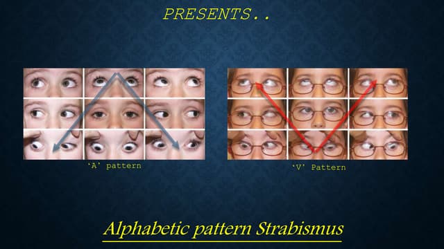Ghostdogg productions present ~ alphabet pattern strabismus  online version