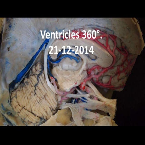 Ventricles 360°