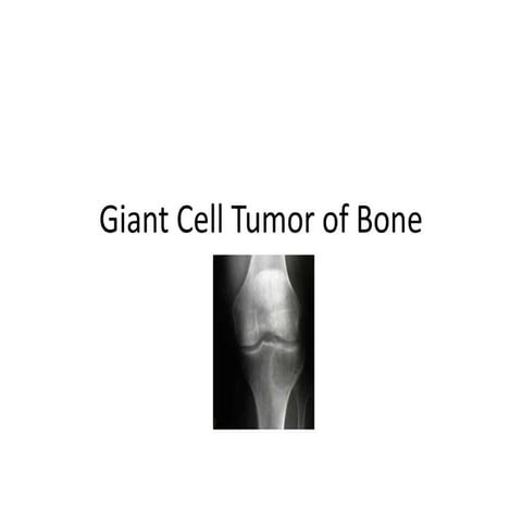 Giant cell tumor of bone
