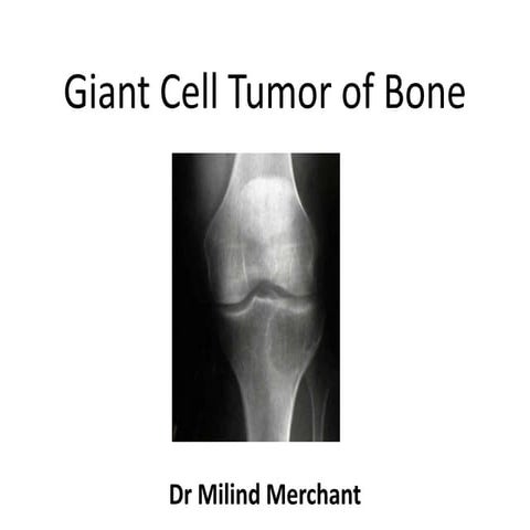 Giant cell tumour of bone