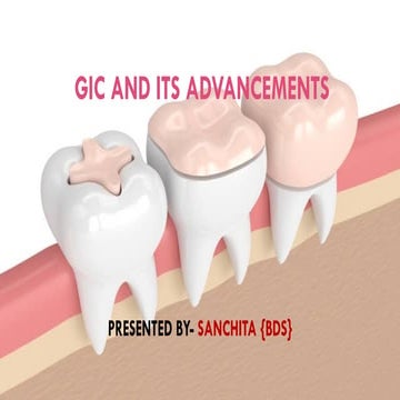 GIC & its Advances Also provides its advantages, disadvantages ...