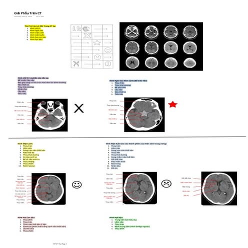 Giải Phẫu Trên CT.pdf