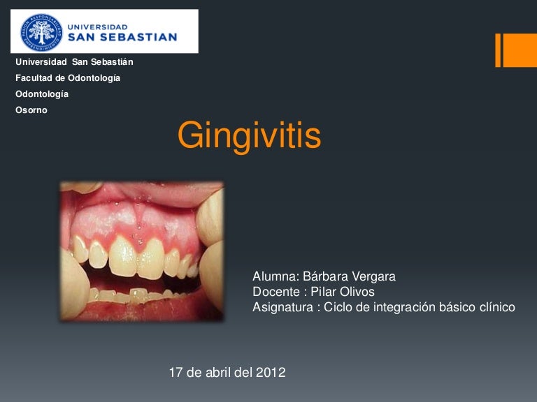 Gingivitis