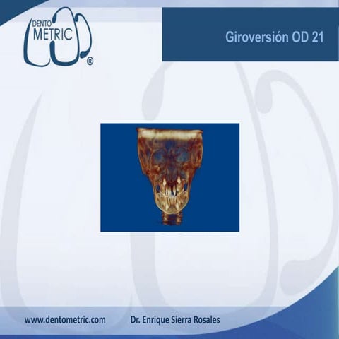 Giroversion OD 21