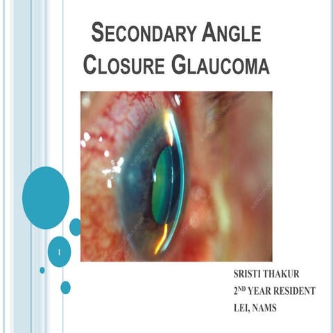 secondary angle closure glaucoma