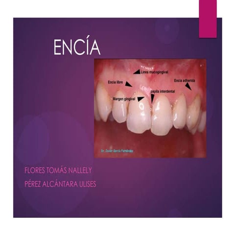 Encía y Glándulas salivales