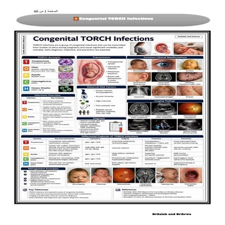 ANTEPARTUM HEMORRHAGE | PPTX