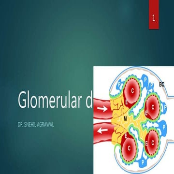 Glomerular disease