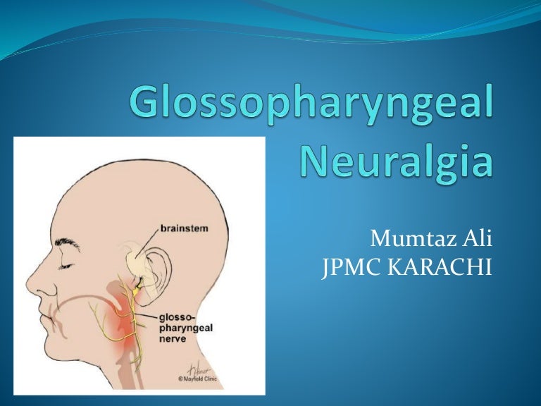 Glossopharyngeal neuralgia presentation