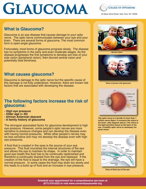 glaucoma and its management.pptx for nursing students | PPTX | Eye and ...