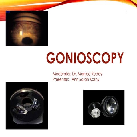 GONIOSCOPY TECHNIQUE AND INVESTIGATION.pptx