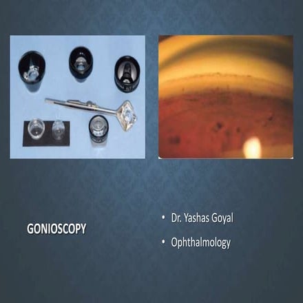 Gonioscopy