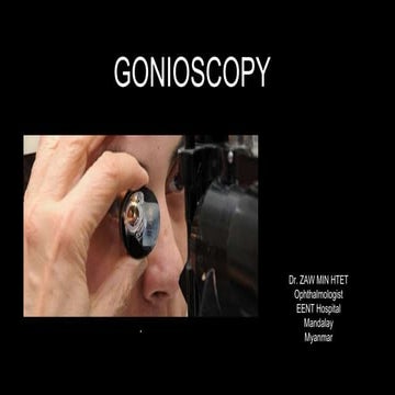 GONIOSCOPY by Dr. ZAW MIN HTET (OPHTHALMOLOGIST)