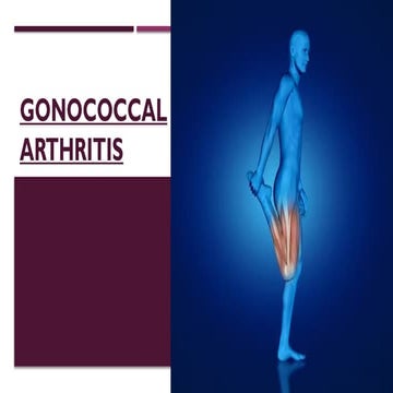 Orthopedic and Infectious Bone Conditions: Sprains, Tuberculosis, Osteomyelit...
