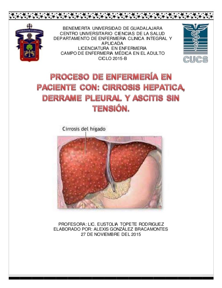 dieta para cirrosis hepatica ascitis dieta para cirrosis hepatica ascitis