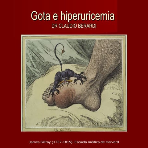 Gota e hiperuricemia