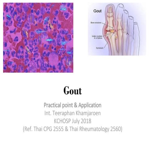 Gout Pdf