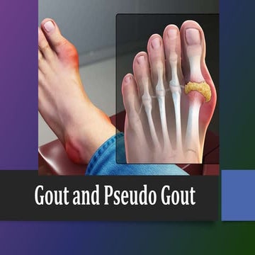 Gout and Pseudogout