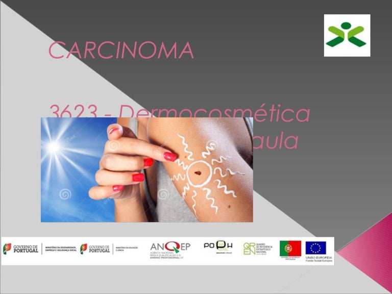 Carcinoma