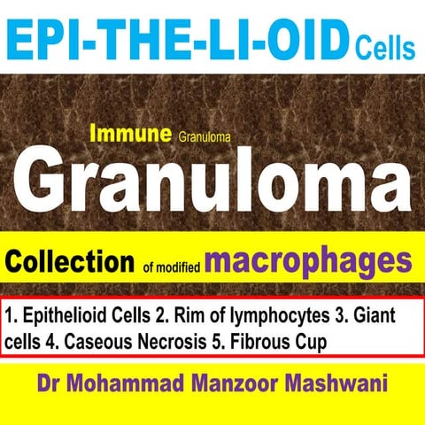 Granuloma lecture st