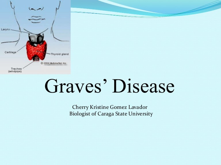 Graves’ disease (An autoimmune Disease)