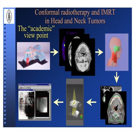 Atlas of organs at risk delineation head and neck region | PDF