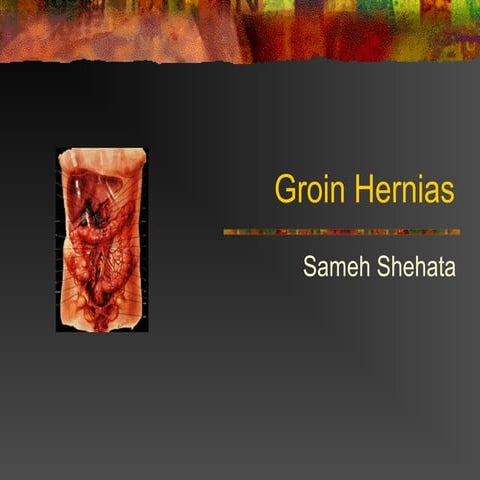 Hernia | PPT