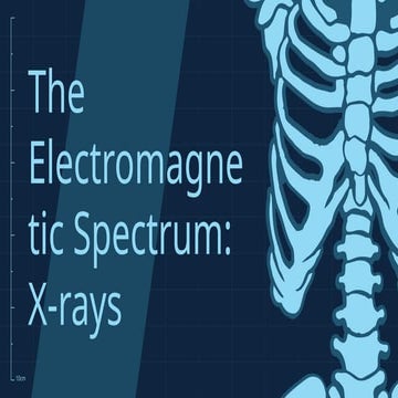 Group six_X-ray presentation.pptx_finals