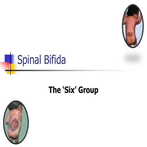 Spinal Bifida