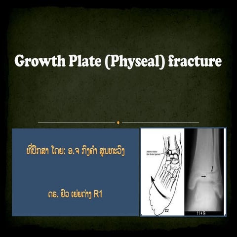 Growth plate (physeal) fracture